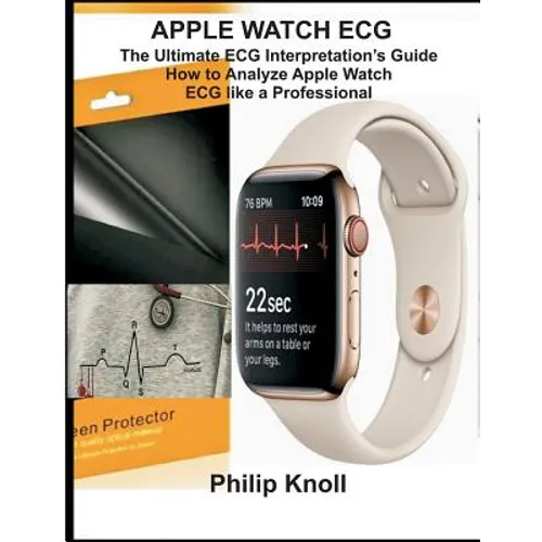 Apple Watch ECG: The Ultimate ECG Interpretation Guide; How to Analyze Apple Watch ECG Like a Professional