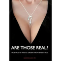 Are Those Real?: True Tales of Plastic Surgery from Beverly Hills