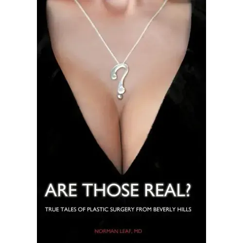 Are Those Real?: True Tales of Plastic Surgery from Beverly Hills