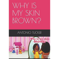 Why Is My Skin Brown?