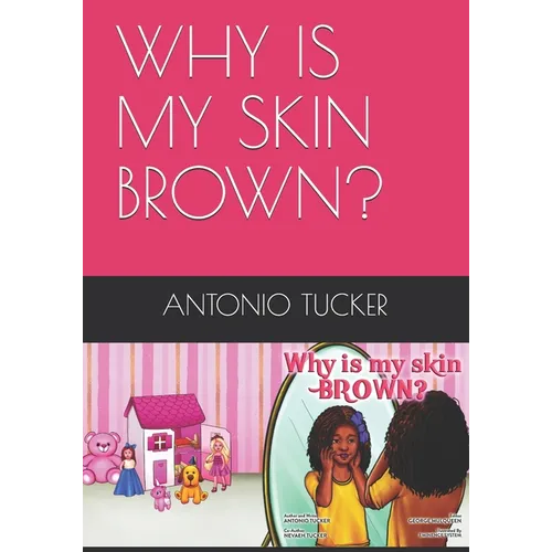 Why Is My Skin Brown?