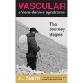 Vascular Ehlers-Danlos Syndrome: The Journey Begins