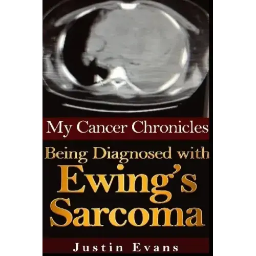 My Cancer Chronicles: Being Diagnosed with Ewing's Sarcoma