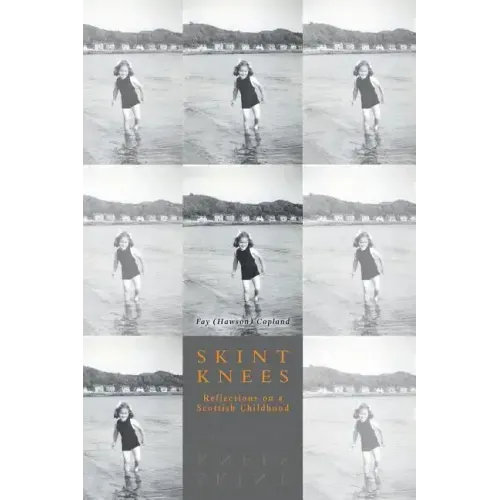 Skint Knees: Reflections on a Scottish Childhood
