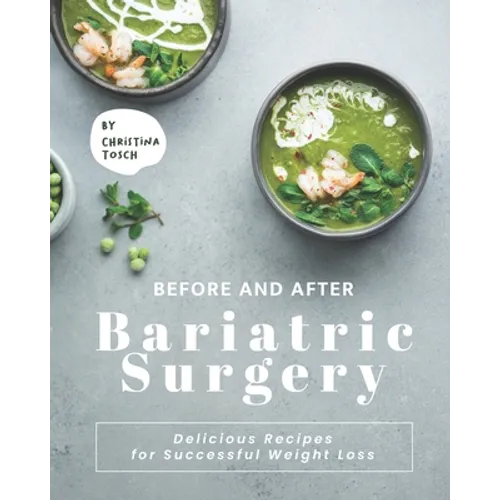 Before and After Bariatric Surgery: Delicious Recipes for Successful Weight Loss