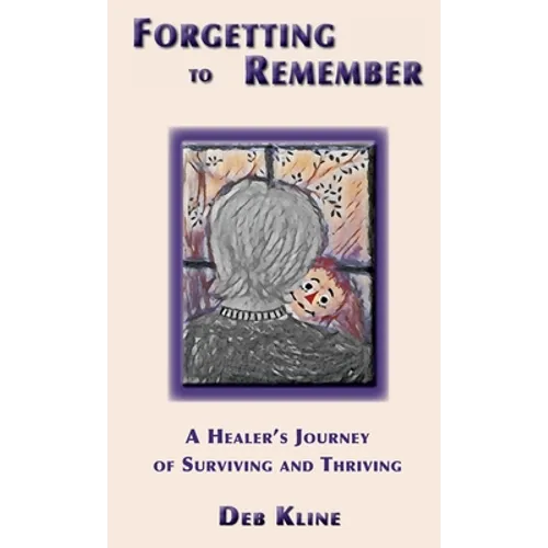 Forgetting to Remember